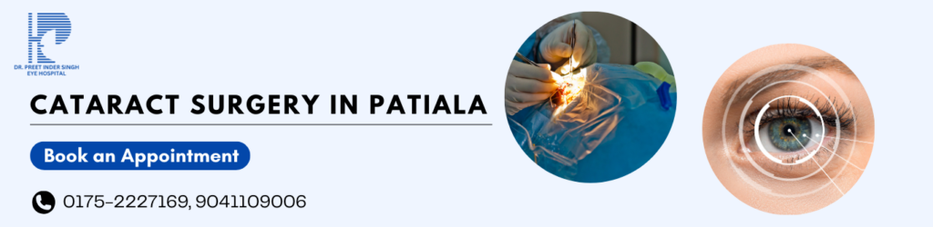 Cataract Surgery in Patiala