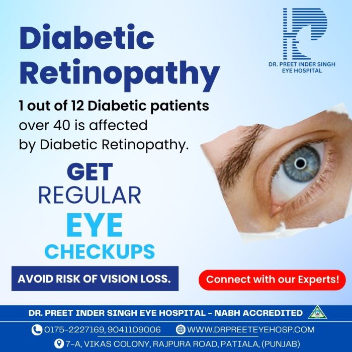 Retina treatment in patiala